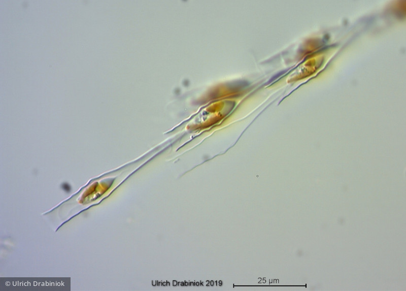 Heterocontophyta Chrysophyceae Ochromonadales Dinobryon bavaricum