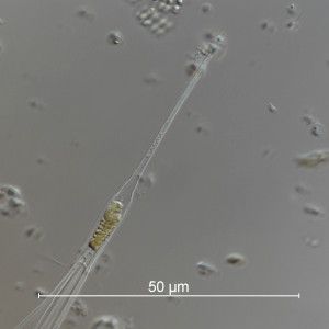 Dinobryon bavaricum