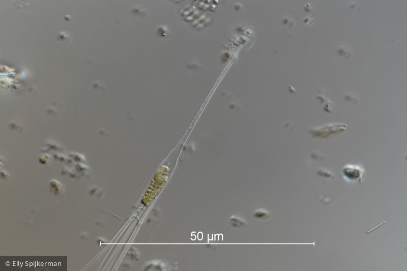 Heterocontophyta Chrysophyceae Ochromonadales Dinobryon bavaricum