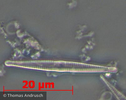 Heterocontophyta Bacillariophyceae Pennales Fragilaria bidens