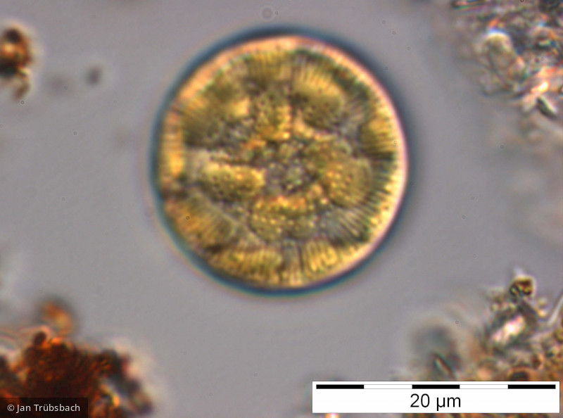 Cyclotella_bodanica_1228301672 - Heterocontophyta Bacillariophyceae Centrales Cyclotella bodanica