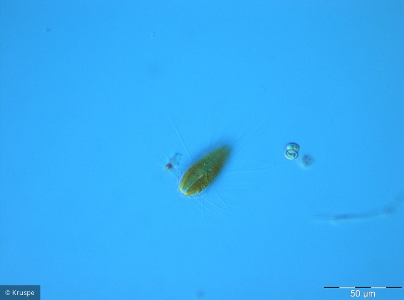 Mallomonas_caudata_1260776919 - Heterocontophyta Chrysophyceae Ochromonadales Mallomonas caudata