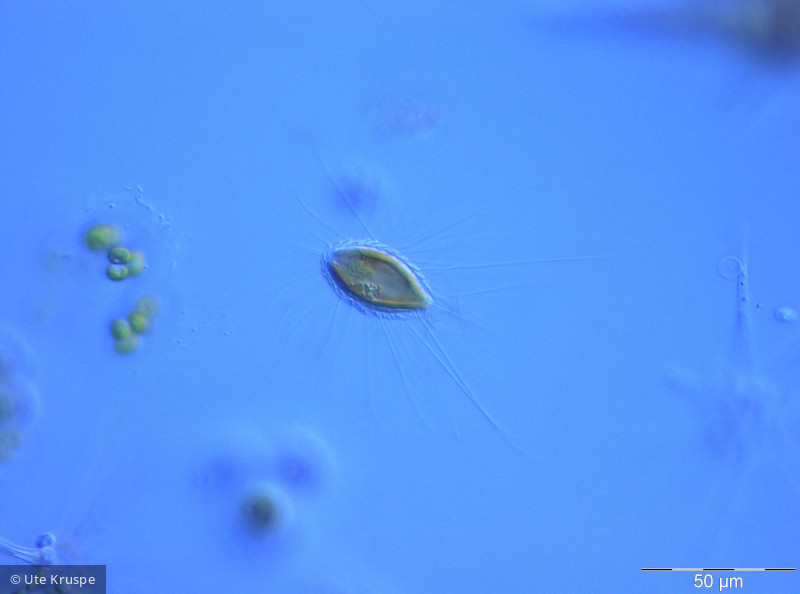 Mallomonas_caudata_1245833209 - Heterocontophyta Chrysophyceae Ochromonadales Mallomonas caudata