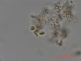 Dictyosphaerium_chlorelloides_1286966217