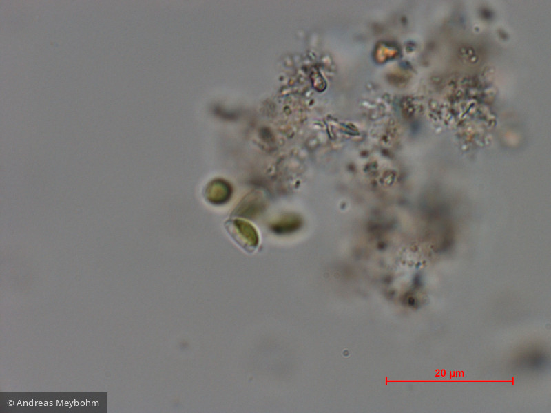 Dictyosphaerium_chlorelloides_1286966217 - Chlorophyta Chlorophyceae Chlorococcales Dictyosphaerium chlorelloides