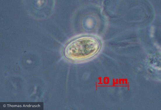 Chlorophyta Chlorophyceae Chlorococcales Lagerheimia ciliata