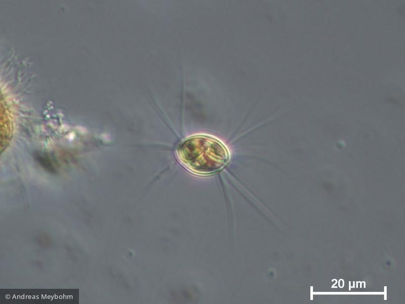 Lagerheimia_ciliata_1280990979 - Chlorophyta Chlorophyceae Chlorococcales Lagerheimia ciliata
