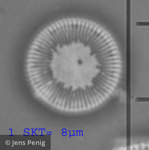 Cyclotella_cyclopuncta_1257521370 - Heterocontophyta Bacillariophyceae Centrales Cyclotella costei