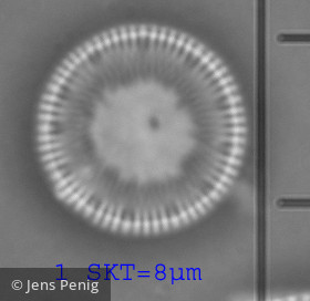 Cyclotella_cyclopuncta_1257521524 - Heterocontophyta Bacillariophyceae Centrales Cyclotella costei