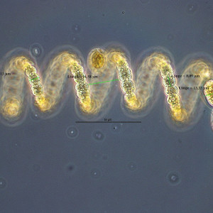 Dolichospermum crassum