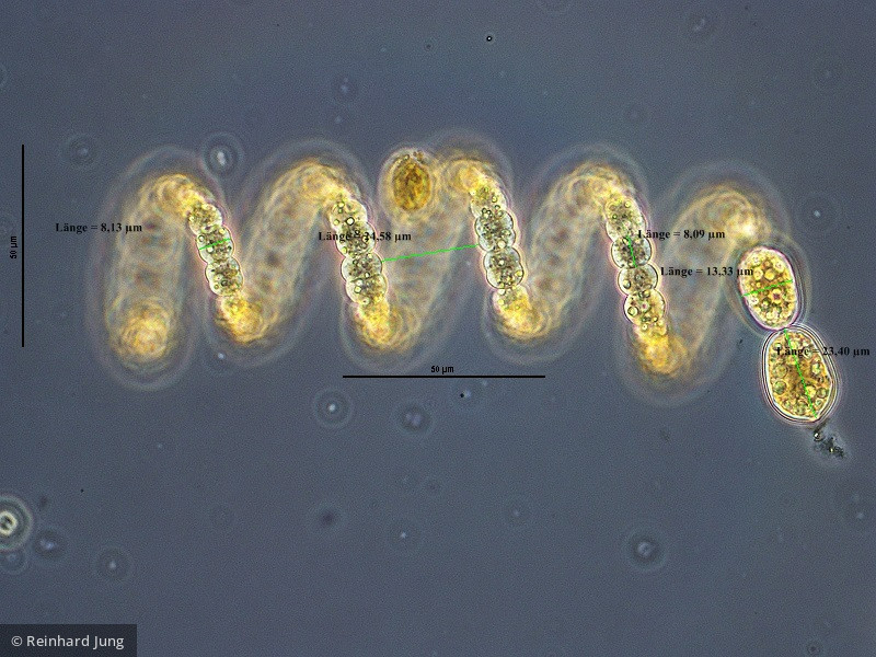 Cyanobacteria Cyanobacteria Nostocales Dolichospermum crassum