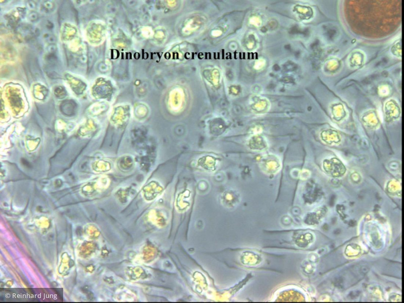 Dinobryon_crenulatum_1226585245 - Heterocontophyta Chrysophyceae Ochromonadales Dinobryon crenulatum