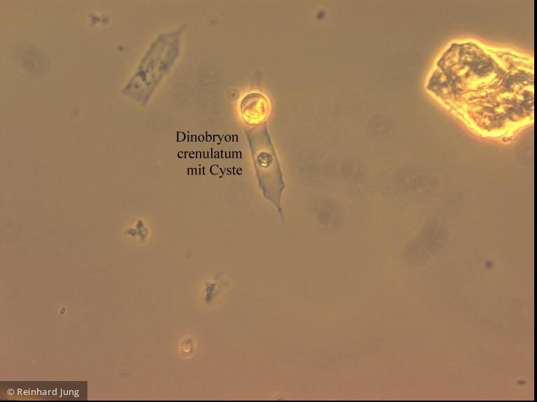 Dinobryon_crenulatum_1226585377 - Heterocontophyta Chrysophyceae Ochromonadales Dinobryon crenulatum