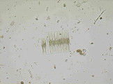 Fragilaria_crotonensis_1238412858