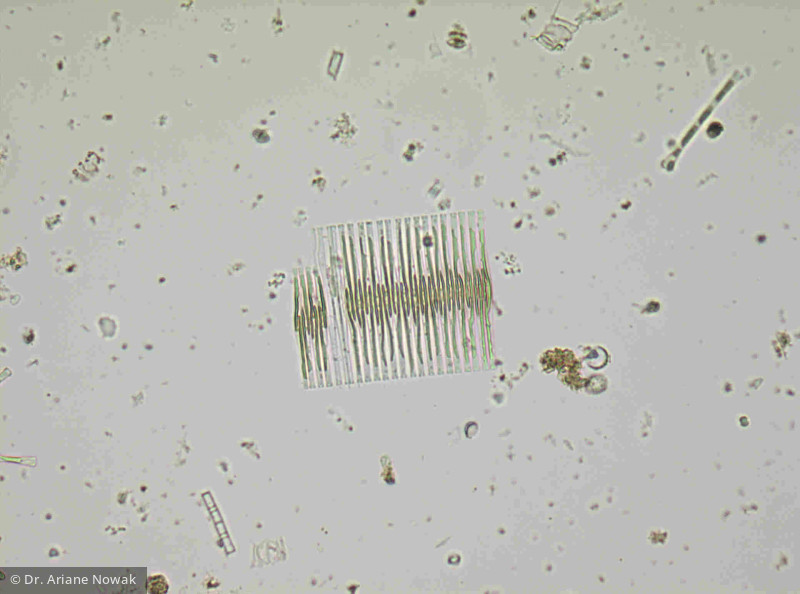 Fragilaria_crotonensis_1238412858 - Heterocontophyta Bacillariophyceae Pennales Fragilaria crotonensis