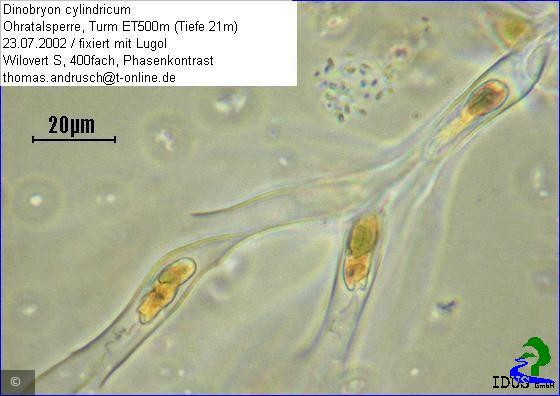 Dinobryon cylindricum · Heterocontophyta Chrysophyceae Ochromonadales