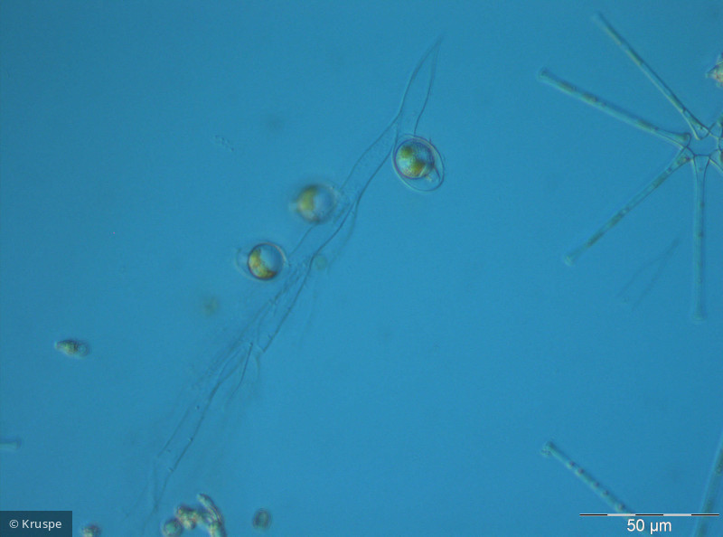Dinobryon cylindricum · Heterocontophyta Chrysophyceae Ochromonadales · 400*x