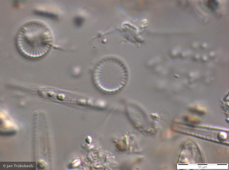 Cyclostephanos_delicatus_1265984087 - Heterocontophyta Bacillariophyceae Centrales Cyclostephanos delicatus