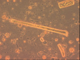 Fragilaria_dilatata_1276599107