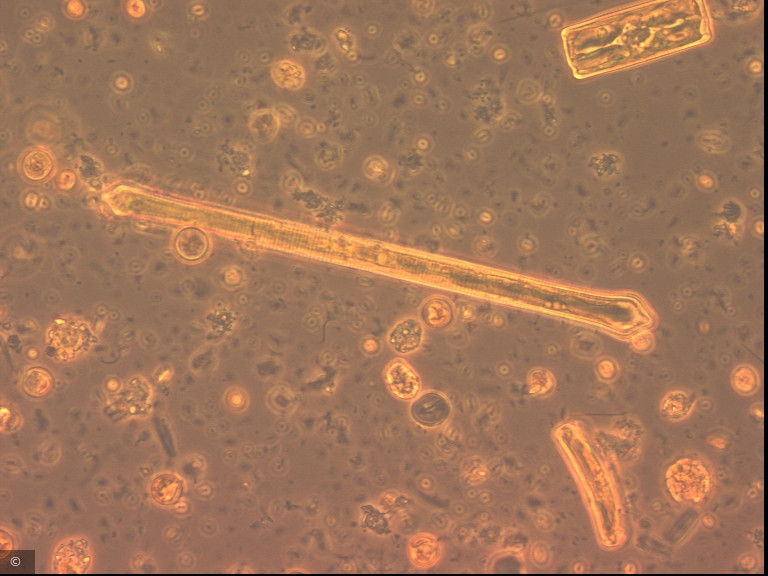 Ulnaria capitata · Heterocontophyta Bacillariophyceae Pennales · Fragilaria_dilatata_1276599107