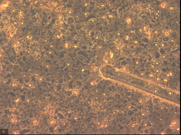 Ulnaria capitata · Heterocontophyta Bacillariophyceae Pennales · Fragilaria_dilatata_1276599313