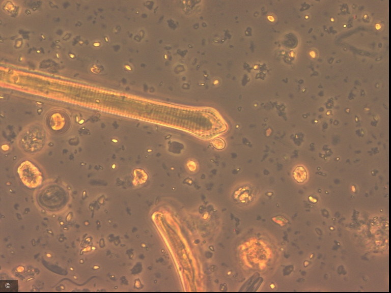 Ulnaria capitata · Heterocontophyta Bacillariophyceae Pennales · Fragilaria_dilatata_1276599386