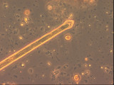 Fragilaria_dilatata_1276599463