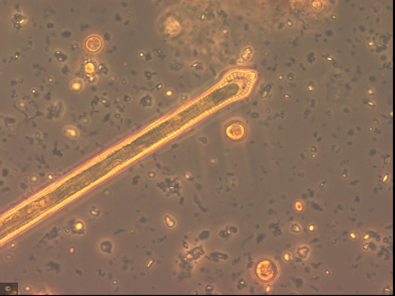 Ulnaria capitata · Heterocontophyta Bacillariophyceae Pennales · Fragilaria_dilatata_1276599463
