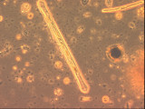 Fragilaria_dilatata_1276599535