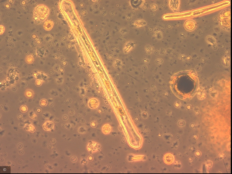 Ulnaria capitata · Heterocontophyta Bacillariophyceae Pennales · Fragilaria_dilatata_1276599535