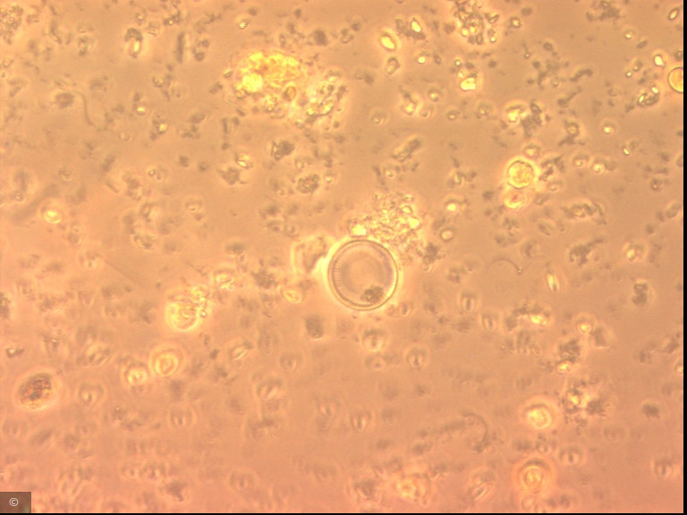 Cyclotella distinguenda · Heterocontophyta Bacillariophyceae Centrales