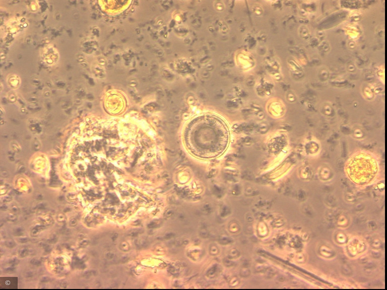 Cyclotella distinguenda · Heterocontophyta Bacillariophyceae Centrales