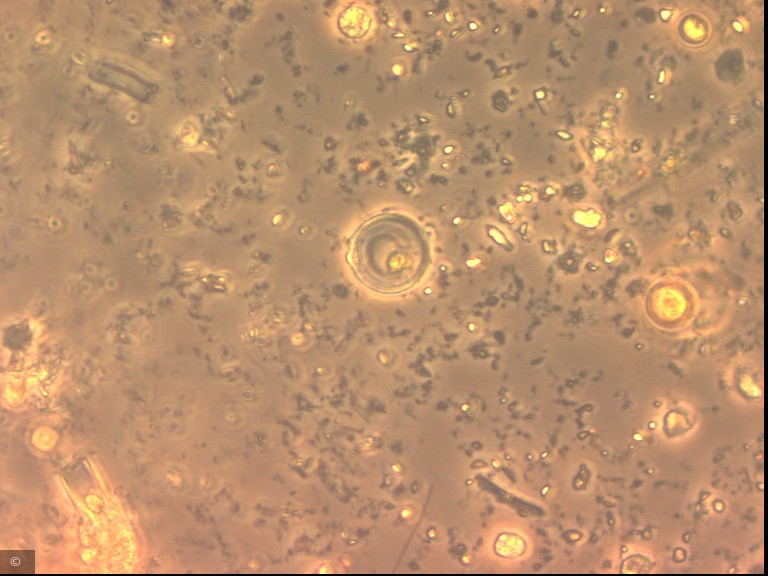 Cyclotella distinguenda · Heterocontophyta Bacillariophyceae Centrales