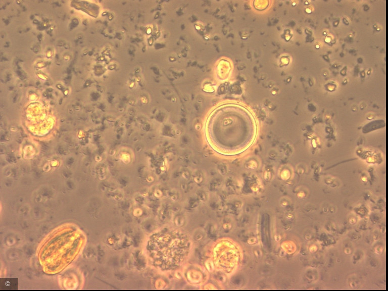 Cyclotella distinguenda · Heterocontophyta Bacillariophyceae Centrales