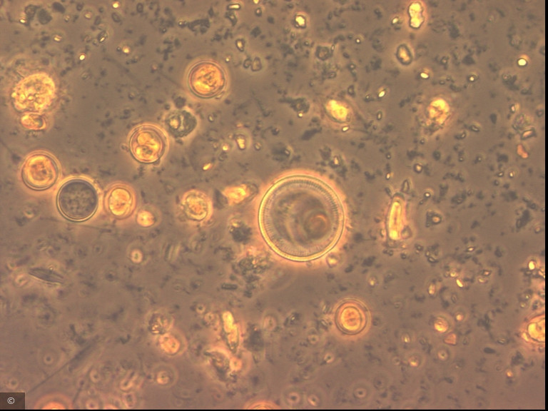 Cyclotella distinguenda · Heterocontophyta Bacillariophyceae Centrales