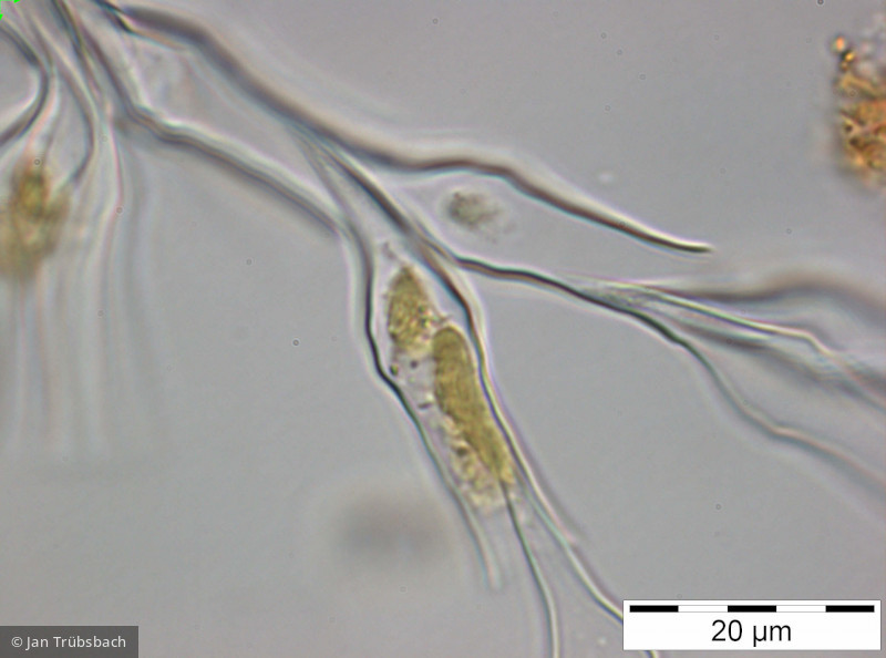 Dinobryon_divergens_1250162020 - Heterocontophyta Chrysophyceae Ochromonadales Dinobryon divergens