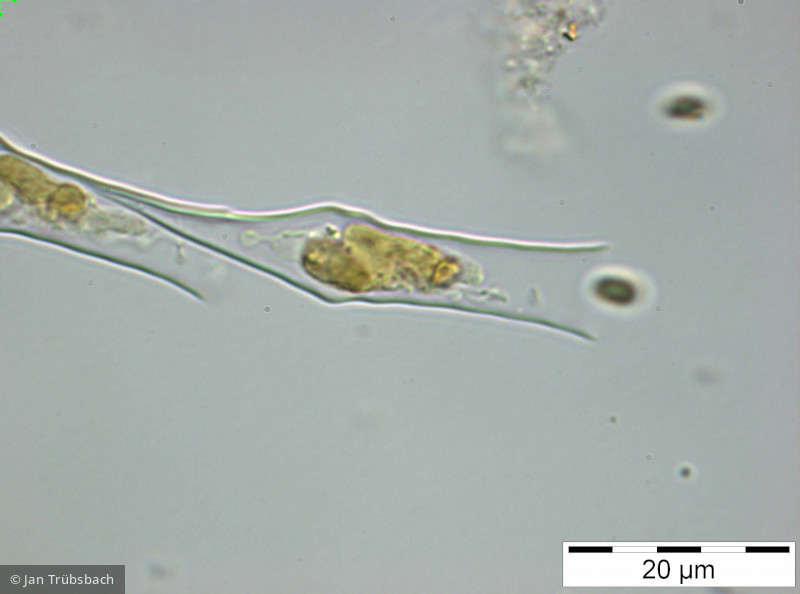 Dinobryon_divergens_1250162845 - Heterocontophyta Chrysophyceae Ochromonadales Dinobryon divergens