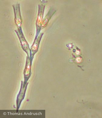 Dinobryon_divergens_1271451276 - Heterocontophyta Chrysophyceae Ochromonadales Dinobryon divergens