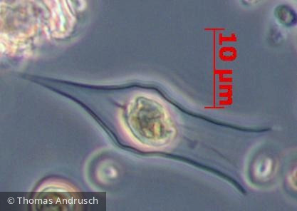 Heterocontophyta Chrysophyceae Ochromonadales Dinobryon divergens