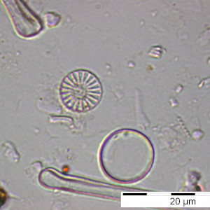Cyclostephanos_dubius_1228406704