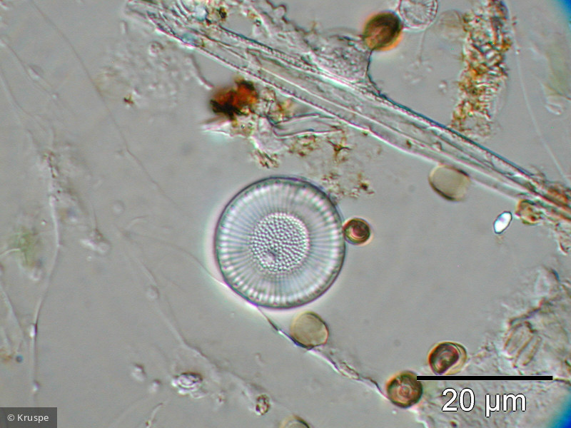 Cyclostephanos_dubius_1260527886 - Heterocontophyta Bacillariophyceae Centrales Cyclostephanos dubius