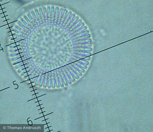 Cyclostephanos_dubius_1271443009 - Heterocontophyta Bacillariophyceae Centrales Cyclostephanos dubius