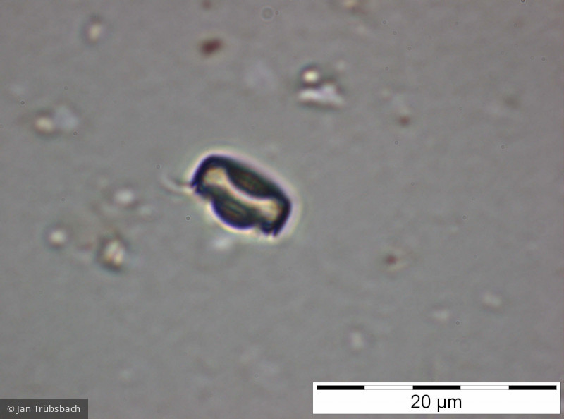 Cyclostephanos_dubius_1228406343 - Heterocontophyta Bacillariophyceae Centrales Cyclostephanos dubius