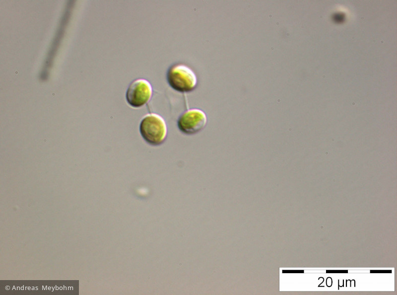 Dictyospaerium_ehrenbergianum_1221728932 - Chlorophyta Chlorophyceae Chlorococcales Dictyosphaerium ehrenbergianum