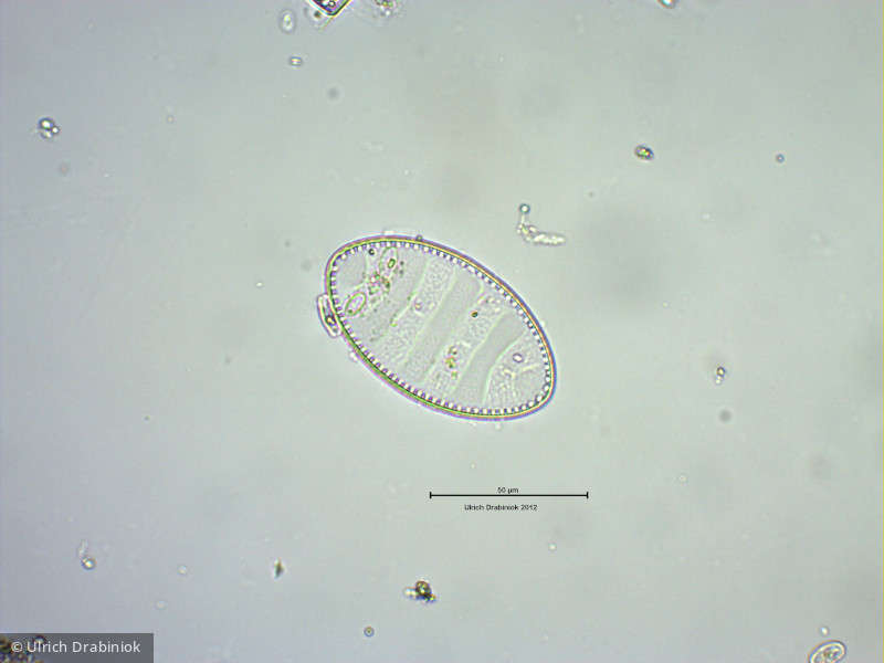 Heterocontophyta Bacillariophyceae Pennales Cymatopleura elliptica