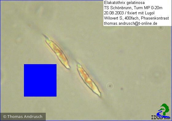Elakatothrix_gelatinosa_1238674114 - Chlorophyta Ulvophyceae Ulotrichales Elakatothrix gelatinosa