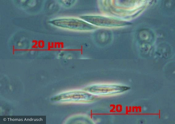 Chlorophyta Ulvophyceae Ulotrichales Elakatothrix gelatinosa