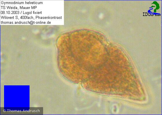 Gymnodinium_helveticum_1238678476 - Dinophyta Dinophyceae Gymnodiniales Gyrodinium helveticum