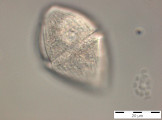Gymnodinium_helveticum_1254210293
