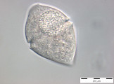 Gymnodinium_helveticum_1254210502